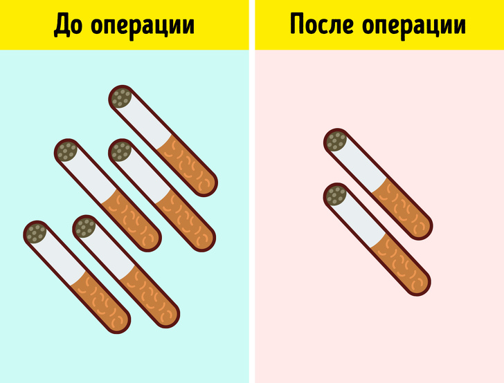 14 нюансів пластичної хірургії, які спростовують міф про її могутність